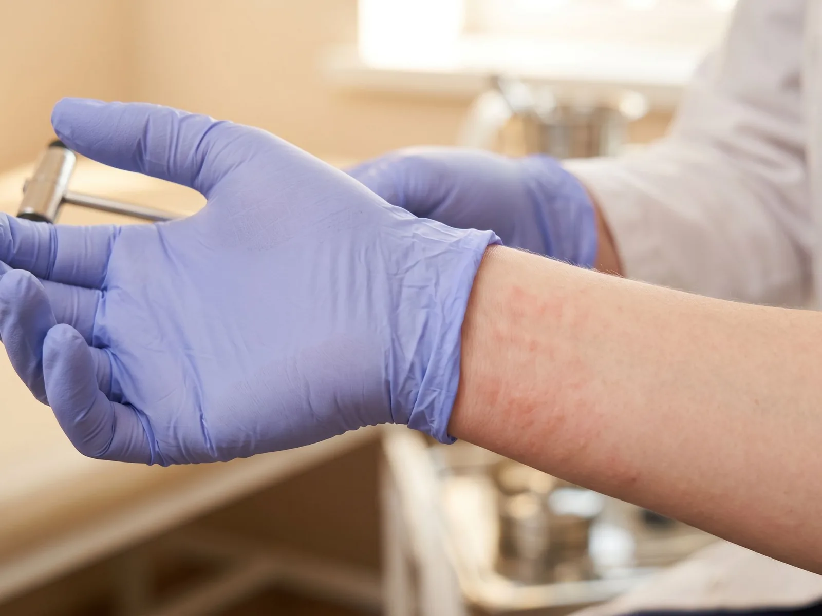 Alergia la latex: simptome, risc și când trebuie investigată